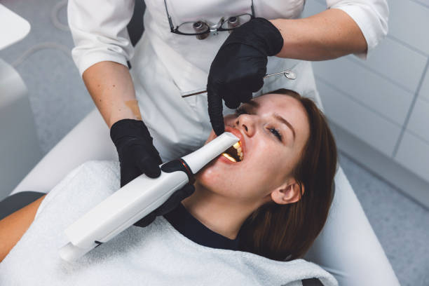 Best Emergency Wisdom Tooth Extraction in Ossun, LA